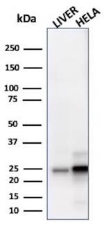 Glutathione S-Transferase Mu3 (GSTM3) Antibody in Western Blot (WB)