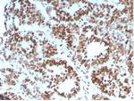 MSH6 (DNA Mismatch Repair Protein) Antibody in Immunohistochemistry (Paraffin) (IHC (P))