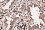 NCOA3 Antibody in Immunohistochemistry (Paraffin) (IHC (P))