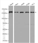 NCOA3 Antibody in Western Blot (WB)