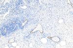 E-selectin/CD62E Antibody in Immunohistochemistry (Paraffin) (IHC (P))