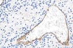 E-selectin/CD62E Antibody in Immunohistochemistry (Paraffin) (IHC (P))