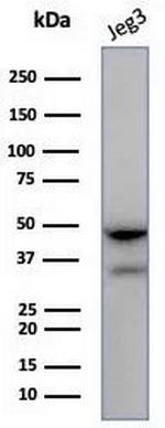 HLA-G (Major Histocompatibility Complex, class I, G) Antibody in Western Blot (WB)