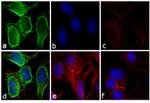 Mouse IgG (H+L) Secondary Antibody in Immunocytochemistry (ICC/IF)