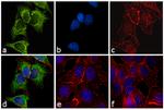 Mouse IgG2a Cross-Adsorbed Secondary Antibody in Immunocytochemistry (ICC/IF)