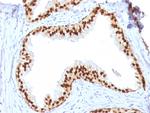 FOXA1/HNF3A Antibody in Immunohistochemistry (Paraffin) (IHC (P))