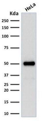 FOXA1/HNF3A Antibody in Western Blot (WB)