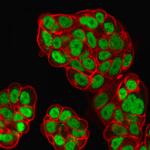 FOXA1/HNF3A Antibody in Immunocytochemistry (ICC/IF)