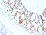 FOXA1/HNF3A Antibody in Immunohistochemistry (Paraffin) (IHC (P))