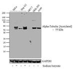 Acetyl-alpha Tubulin (Lys40) Antibody in Western Blot (WB)