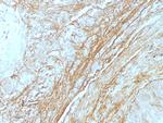 Tenascin C (Stromal Marker for Epithelial Malignancy) Antibody in Immunohistochemistry (Paraffin) (IHC (P))