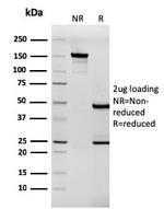 Tenascin C Antibody in SDS-PAGE (SDS-PAGE)