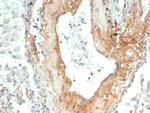 Tenascin C (Stromal Marker for Epithelial Malignancy) Antibody in Immunohistochemistry (Paraffin) (IHC (P))