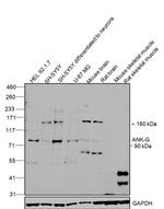 Ankyrin G Antibody in Western Blot (WB)