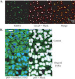 NFkB p65 Antibody in Immunocytochemistry (ICC/IF)