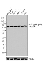 NFkB p65 Antibody in Western Blot (WB)