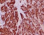 IDH1-R132H (Isocitrate Dehydrogenase) Antibody in Immunohistochemistry (Paraffin) (IHC (P))