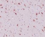 IDH1-R132H (Isocitrate Dehydrogenase) Antibody in Immunohistochemistry (Paraffin) (IHC (P))