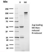 ZNF81/Zinc finger protein 81 (Transcription Factor) Antibody in SDS-PAGE (SDS-PAGE)