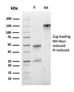Insulin-like Growth Factor-1 (IGF-1) Antibody in SDS-PAGE (SDS-PAGE)