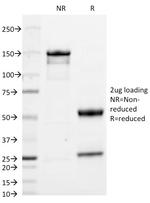 IgA (Immunoglobulin Alpha Heavy Chain) (B-Cell Marker) Antibody in SDS-PAGE (SDS-PAGE)