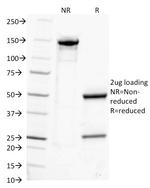 IgG (Immunoglobulin Gamma Heavy Chain) (B-Cell Marker) Antibody in SDS-PAGE (SDS-PAGE)