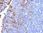 IgG (Immunoglobulin Gamma Heavy Chain) (B-Cell Marker) Antibody in Immunohistochemistry (Paraffin) (IHC (P))