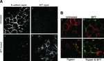 PAR2 Antibody in Immunocytochemistry (ICC/IF)