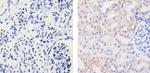 EphB4 Antibody in Immunohistochemistry (Paraffin) (IHC (P))