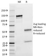 Lambda Light Chain (B-Cell Marker) Antibody in SDS-PAGE (SDS-PAGE)