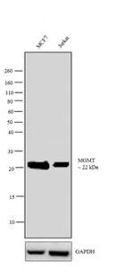 MGMT Antibody in Western Blot (WB)