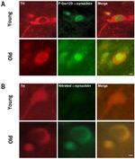 alpha Synuclein Antibody in Immunohistochemistry (IHC)