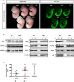 VEGF Receptor 1 (soluble) Antibody in Western Blot (WB)