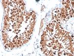Inhibin, alpha (INHA) (Gonadal Cell Marker) Antibody in Immunohistochemistry (Paraffin) (IHC (P))