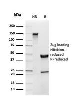 Inhibin, alpha (INHA) (Gonadal Cell Marker) Antibody in SDS-PAGE (SDS-PAGE)