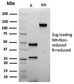 Inhibin, alpha (INHA) (Gonadal Cell Marker) Antibody in SDS-PAGE (SDS-PAGE)
