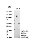 Insulin/IRDN (beta-Cell and Insulinoma Marker) Antibody in SDS-PAGE (SDS-PAGE)