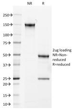 Androgen Receptor (Marker of Androgen Dependence) Antibody in SDS-PAGE (SDS-PAGE)
