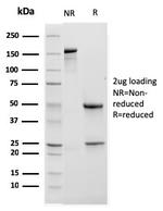 CD11b/MAC-1 Antibody in SDS-PAGE (SDS-PAGE)