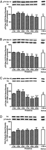 Phospho-Tyrosine Hydroxylase (Ser31) Antibody in Western Blot (WB)