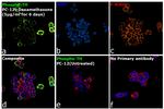 Phospho-Tyrosine Hydroxylase (Ser40) Antibody