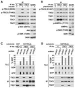 TSC2 Antibody in Immunoprecipitation (IP)