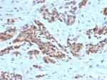 ARF1 (Golgi Apparatus Marker) Antibody in Immunohistochemistry (Paraffin) (IHC (P))