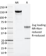 ARF1 (Golgi Apparatus Marker) Antibody in SDS-PAGE (SDS-PAGE)