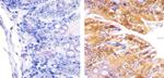 PLK1 Antibody in Immunohistochemistry (Paraffin) (IHC (P))