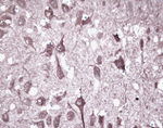 PGP9.5 Antibody in Immunohistochemistry (IHC)