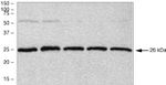 PGP9.5 Antibody in Western Blot (WB)