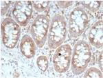 Laminin Receptor/ RPSA (Marker of Metastatic Potential) Antibody in Immunohistochemistry (Paraffin) (IHC (P))