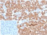 Laminin Receptor/ RPSA (Marker of Metastatic Potential) Antibody in Immunohistochemistry (Paraffin) (IHC (P))