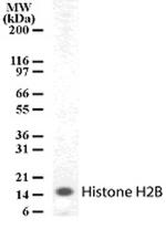 Histone H2B Antibody in Western Blot (WB)